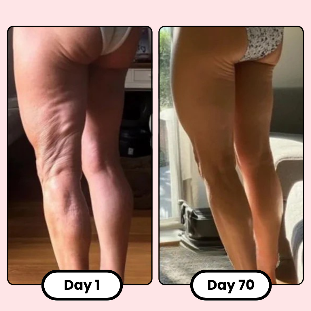Firmé Cellulite Roller