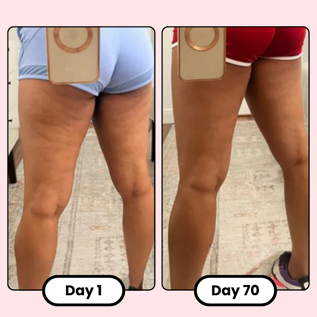 Firmé Cellulite Roller