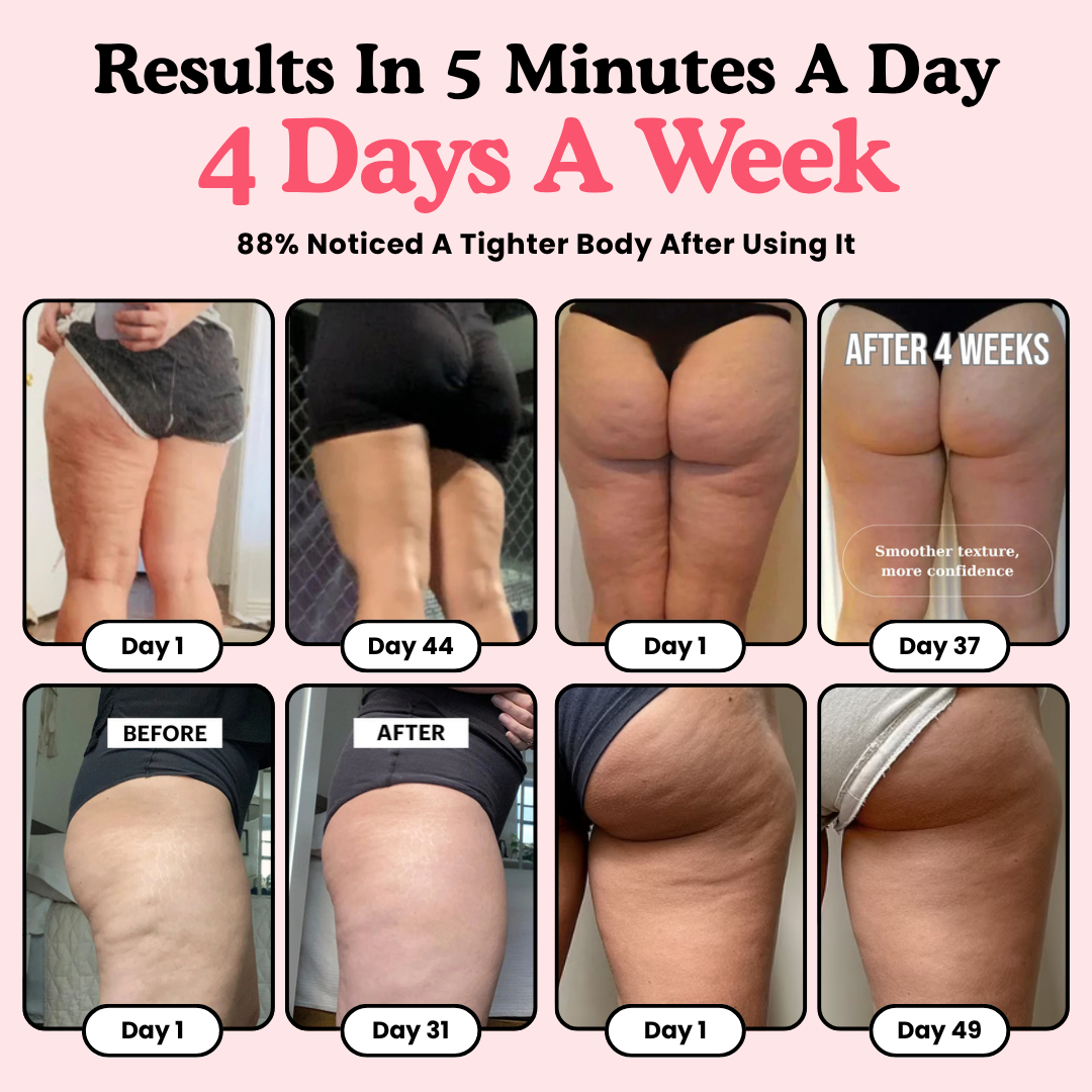 Firmé Cellulite Roller